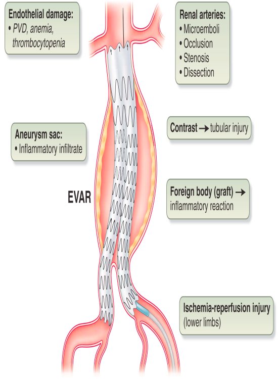 Interventional Radiology Equipment
